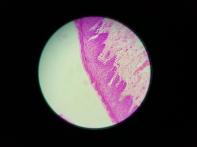 Stratified Squamous Epithelium Slides - Stratified Squamous Epithelium 09 400X